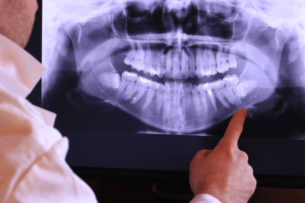 Best Emergency Dental Extractions in Yale, OK